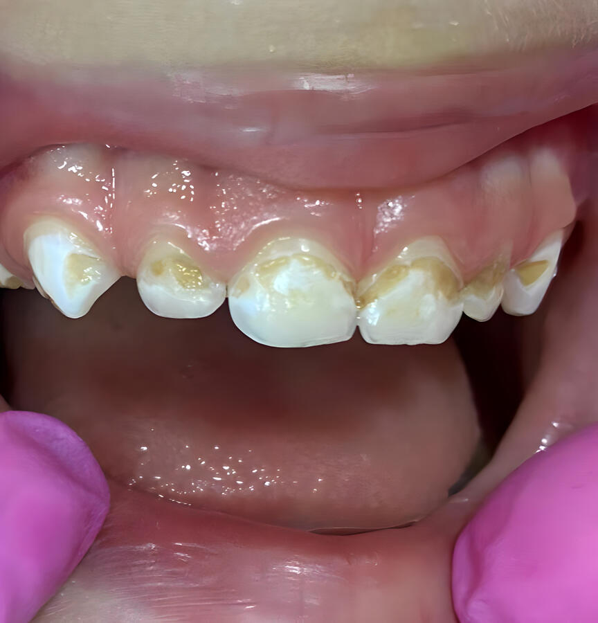 Restauração & Reabilitação Bucal